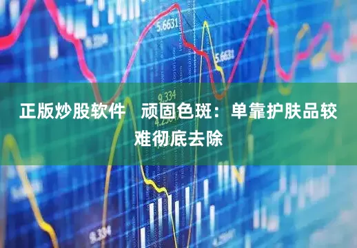 正版炒股软件   顽固色斑：单靠护肤品较难彻底去除