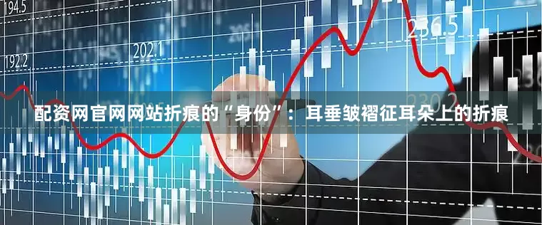 配资网官网网站折痕的“身份”：耳垂皱褶征耳朵上的折痕